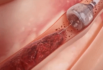 151333880162730.GIF