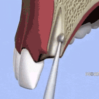 154485060293280.gif