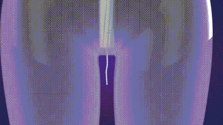 154496229293409.gif