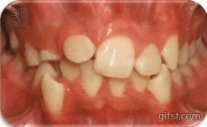 157730614732933.gif