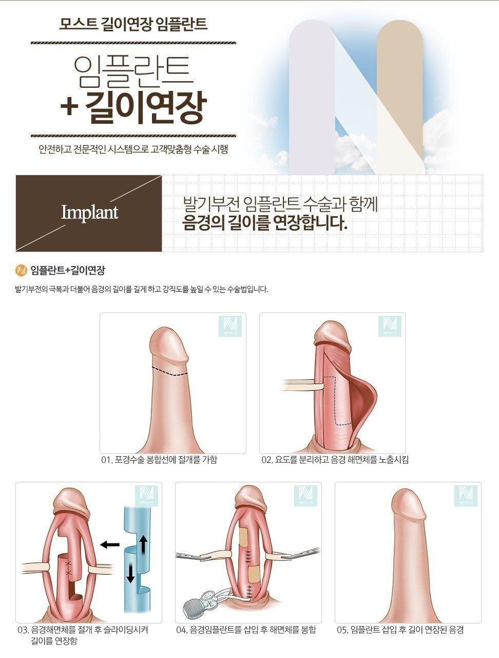 [유머] 7000번 수술한 비뇨기과 의사도 불가능하다는 영역 -  와이드섬